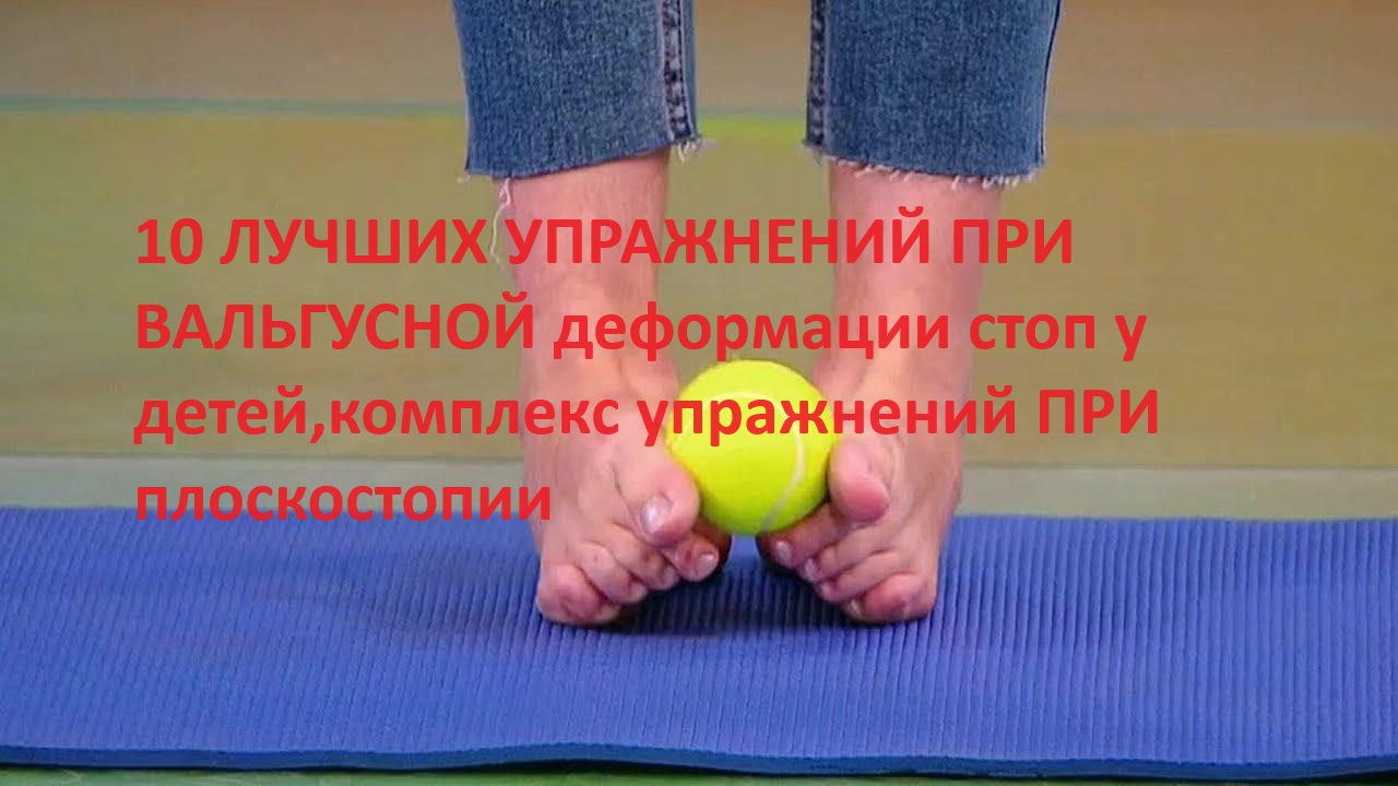 10 ЛУЧШИХ УПРАЖНЕНИЙ ПРИ ВАЛЬГУСНОЙ деформации стоп у детей,комплекс упражнений ПРИ плоскостопии
