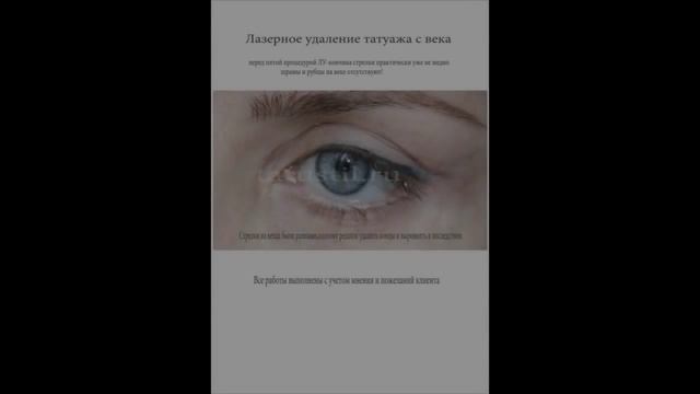 Лазерное удаление татуировок и татуажа в г смотреть онлайн