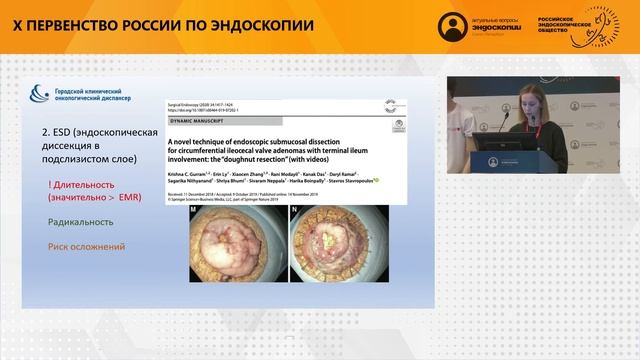 ЭНДОСКОПИЧЕСКОЕ УДАЛЕНИЕ ЭПИТЕЛИАЛЬНОГО ОБРАЗОВАНИЯ БАУГИНИЕВОЙ ЗАСЛОНКИ