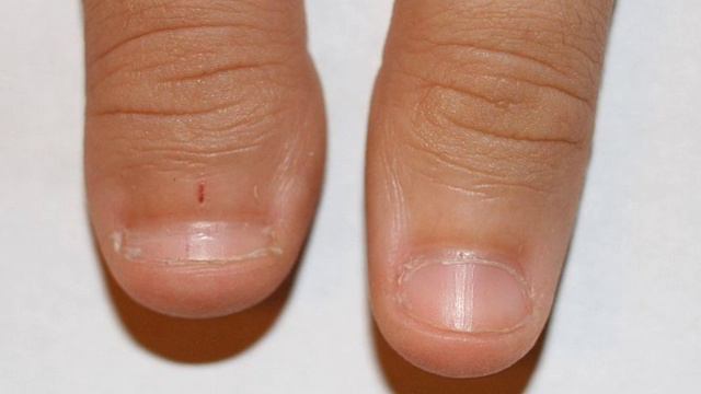 হাতের নখের 16টি লক্ষন দেখে জেনে নিন আপনার ভবিষ্যত,নখে সাদা দাগ থাকলে/hater nakh dekhe vabishat janu смотреть онлайн