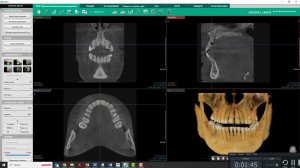 Построение панорамы в программе Ez3D i