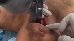 Интубация трахеи    tracheal intubation