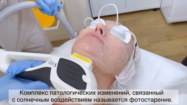Фотоомоложение: удаление сосудов, пигментации, омоложение, лифтинг, лечение акне и постакне смотреть онлайн