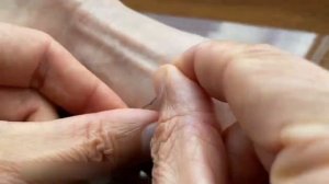 Как Вытащить Клеща Ниткой БЕЗОПАСНО