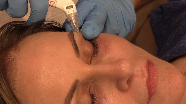 Virtue Exact RF Under Eye Treatment Demonstration смотреть онлайн