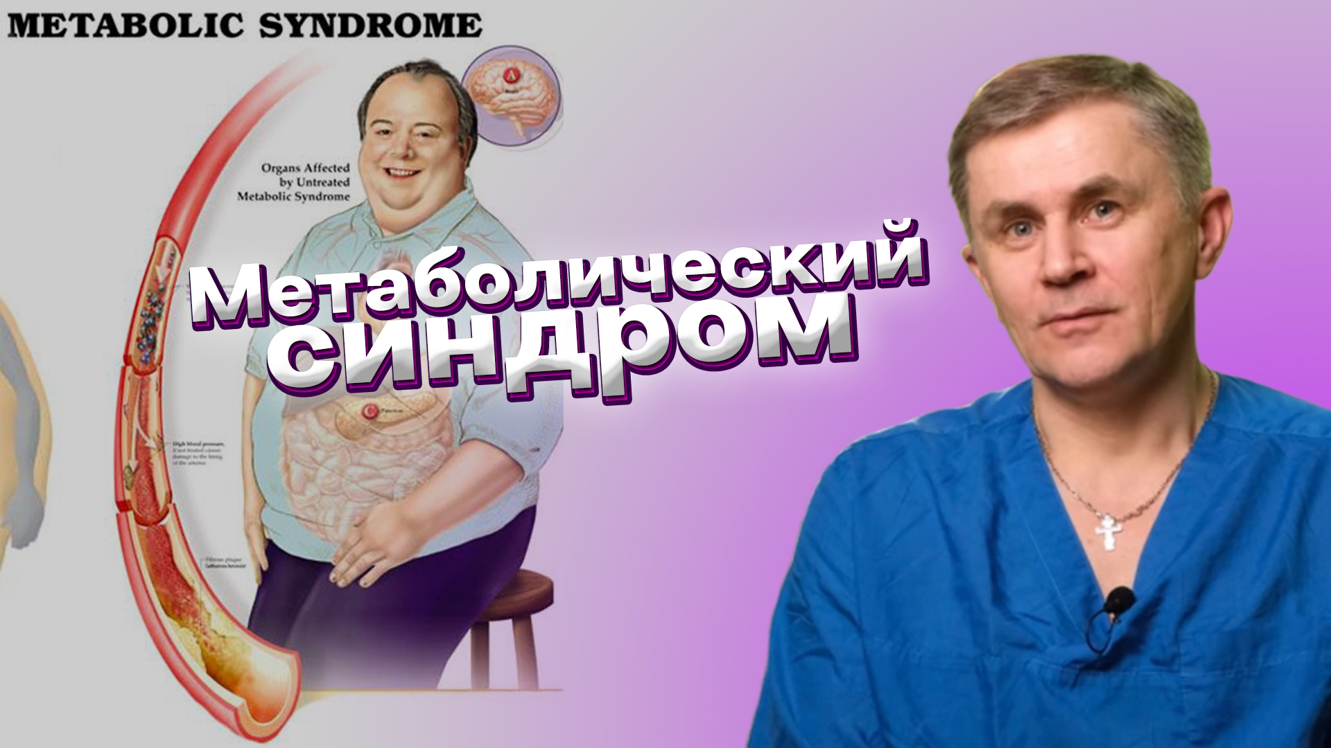 Метаболический синдром