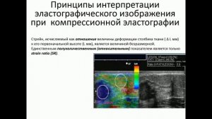 Введение в ЭЛАСТОГРАФИЮ