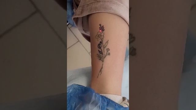Удаление татуировки - ветки. #удалениетатуировки #notattoo #партак