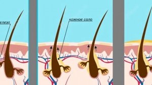 Жирная кожа головы