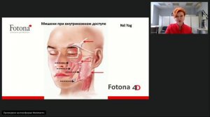 Вебинар 11.09.23. Запатентованный режим Fotona PIANO