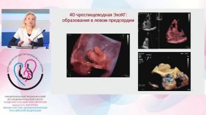 Современная УЗИ-диагностика сердца и сосудов