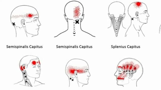 АРУУ ТАҢ// БАШТАГЫ ШАКЫЙ ООРУСУ ЭМНЕДЕН УЛАМ ПАЙДА БОЛОТ.. смотреть онлайн