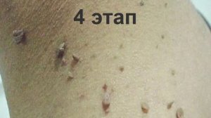 7 этапов загрязнения организма