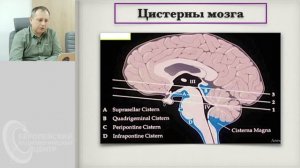КТ анатомия головного мозга. Андрей Мангов