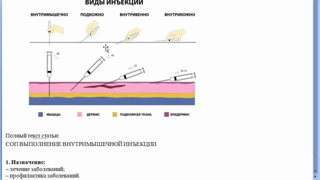 ВНУТРИМЫШЕЧНАЯ ИНЪЕКЦИЯ