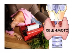 АутоИммунный тиреоидит (АИТ): реальные причины и следствие