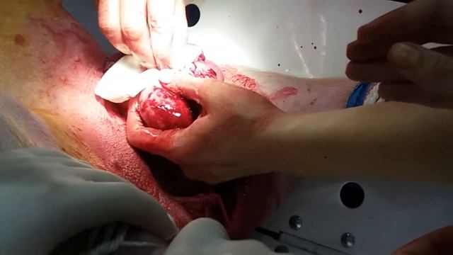 Грыжесечение 4 смотреть онлайн