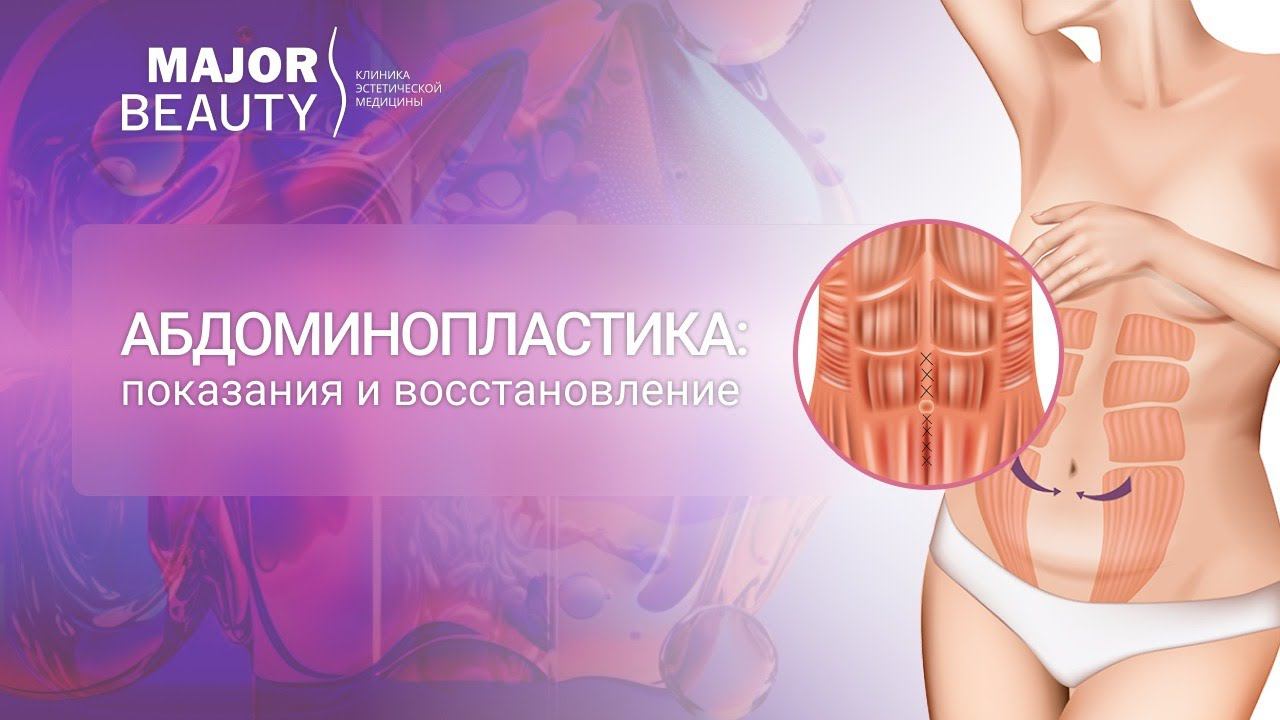 Абдоминопластика в Major Beauty