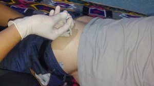 seftriakson antibiotik og'riqsiz yuborish. цефтриаксон мушак орасига оғриқсиз юбориш