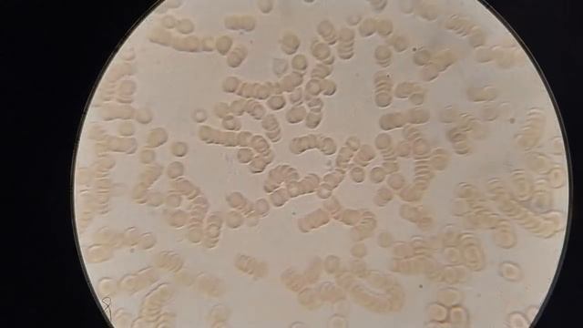 Кровь после эфирных масел смотреть онлайн