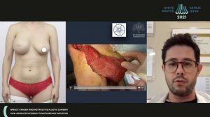 Symmetrisation surgery: when, what, to whom (Dmitry Melnikov)