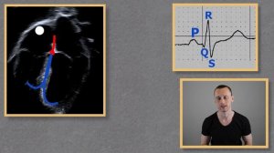 Миграция водителя ритма | ЭКГ