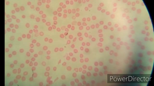 ЧТО НАХОДИТСЯ  В ЧЕЛОВЕЧЕСКОЙ КРОВИ // КРОВЬ ПОД МИКРОСКОПОМ смотреть онлайн