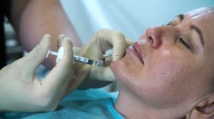 Филлеры Success: Подглазничная область и нижняя треть лица.