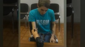 Пациенты с бионическим протезом кисти Vincent Systems