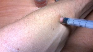 Избавиться от клеща