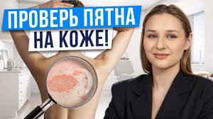 ПЯТНА НА КОЖЕ после ЛАЗЕРА! / Как ЛЕЧИТЬ отрубевидный лишай?