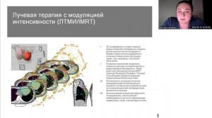 Скальпель или луч: дискуссия онкохирурга и радиолога