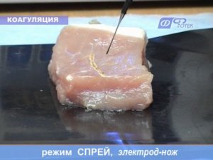 Видеоруководство по применению аппарата "ФОТЕК Е81М"