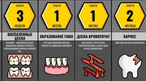 Что Будет Если Перестать Чистить Зубы