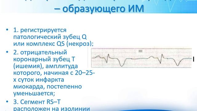 ЭКГ при ишемической болезни сердца. Артемова Н.М.