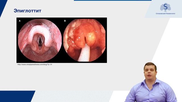 Болезни ЛОР-органов в педиатрической практике. Часть 2 смотреть онлайн