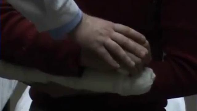 Методика иммобилизации кисти - наложение транспортной шины.mp4