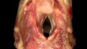 ГОРТАНЬ. Анатомия человека. Атлас Акланда. Русский перевод А. Пилюгина. ЧАСТЬ 4.5