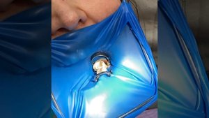 Восстановление жевательного зуба.