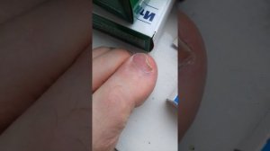 116 ДНЕЙ ЛЕЧЕНИЯ НОГ ОТ ГРИБКА НАЧАЛО 5 ТОГО МЕСЯЦА ИТРАКОНАЗОЛ 1день