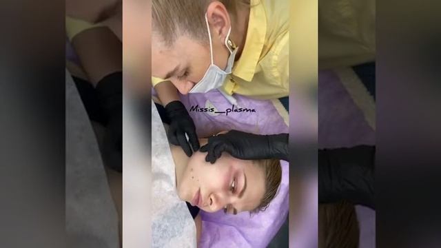 удаление жировиков, чистка лица холодной плазмой смотреть онлайн