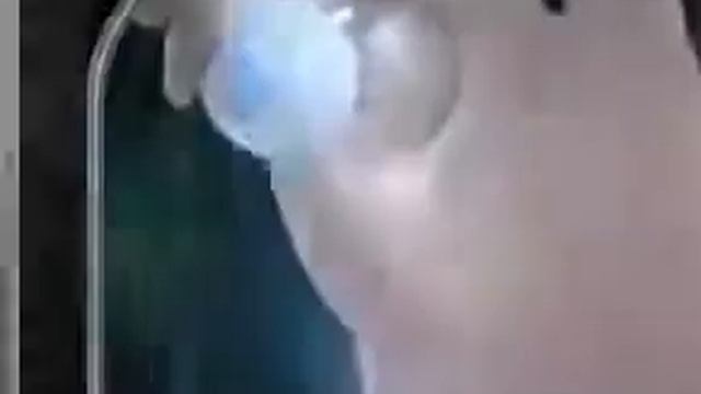 целлюлит на ягодицах как избавиться