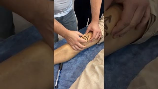 Тестирование подвижности надколенника смотреть онлайн