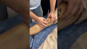 Тестирование подвижности надколенника