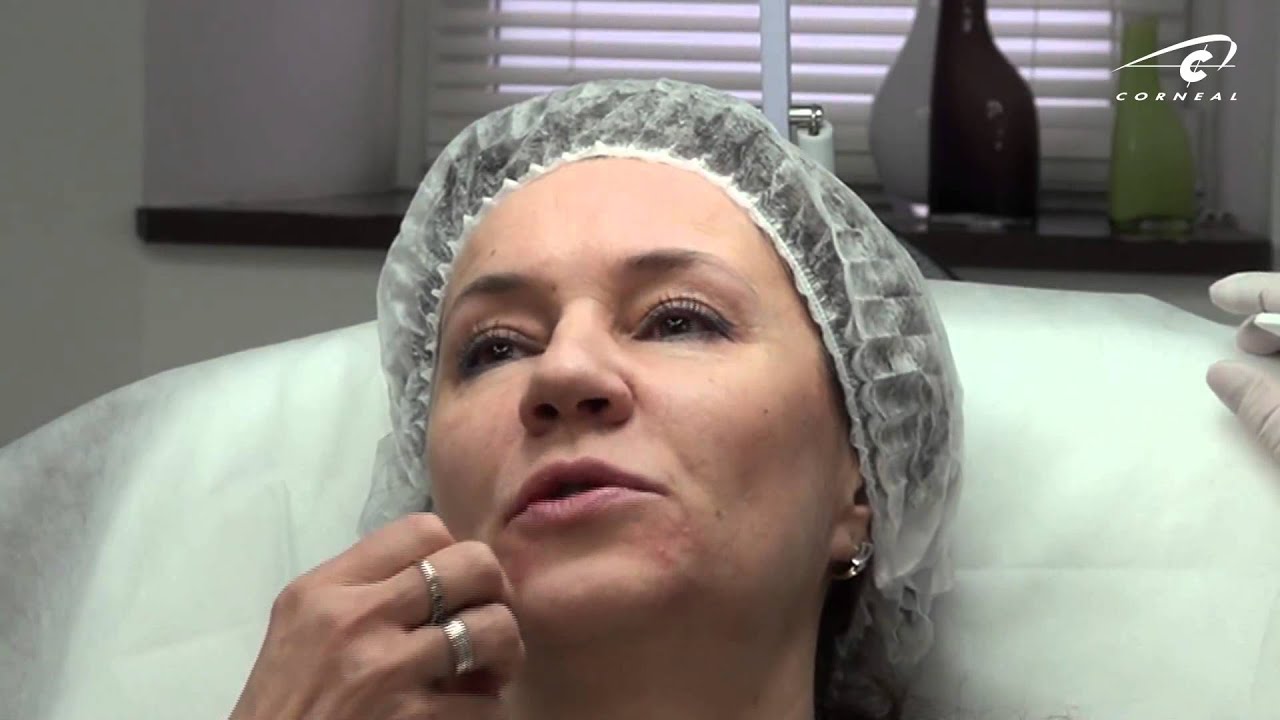 Колоть губы с больным горлом. Схема введения филлера в губы. Больно колоть губы. Больно ли колоть губы ботоксом. Больно колоть губы.