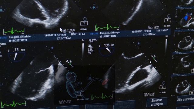 Can I travel during pregnancy by air from saudi arabia смотреть онлайн