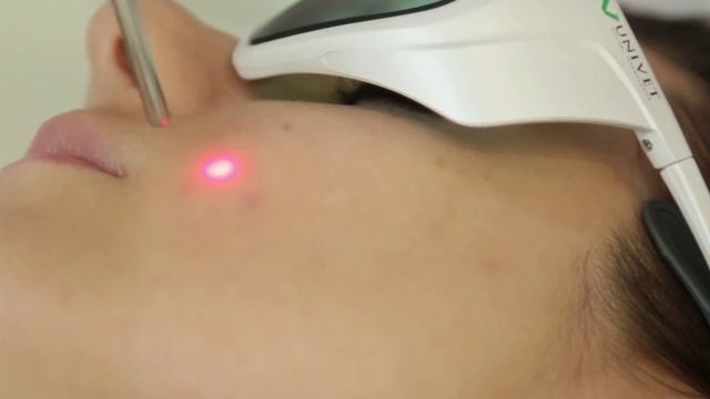 НОВЫЕ ЛАЗЕРНЫЕ ТЕХНОЛОГИИ!!! смотреть онлайн