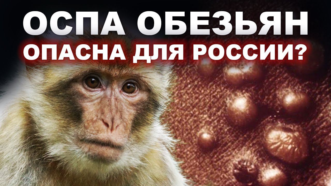Оспа обезьян. Опасна для России? Смотрим в будущее: что происходит в мире / Мария Самарина смотреть онлайн