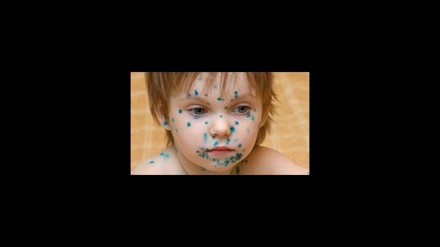 Как отмыть зеленку? смотреть онлайн