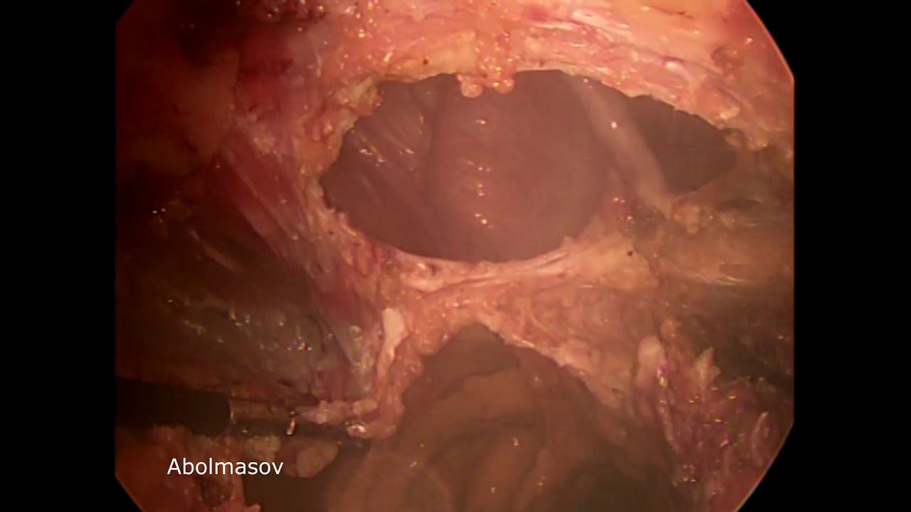 eTEP TAR M23W2R0 double speed смотреть онлайн